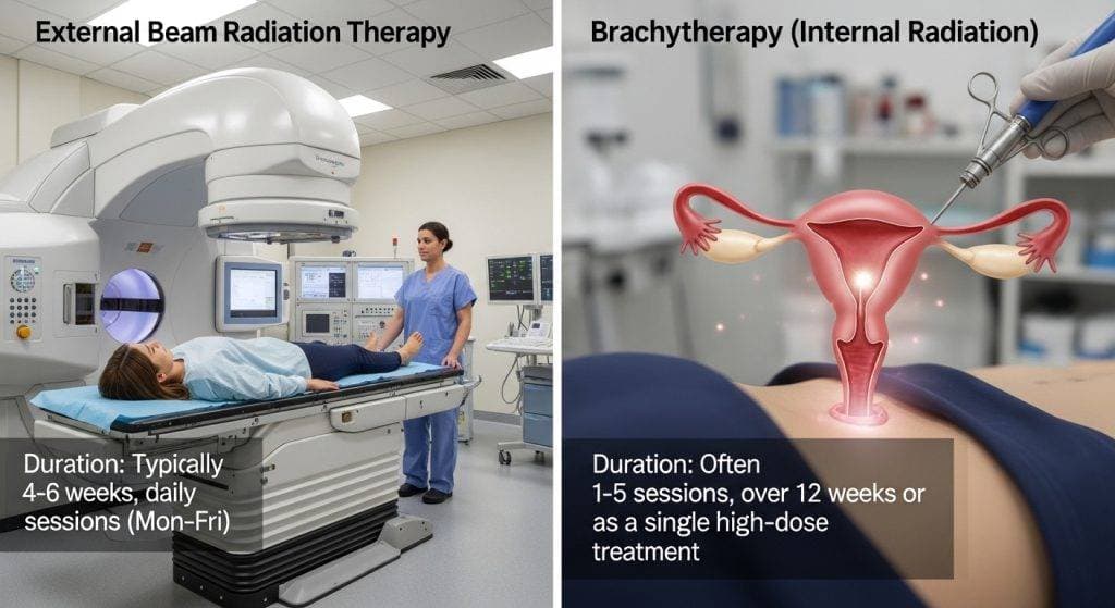 How Long Is Radiation Treatment for Endometrial Cancer? — Dr. lucas