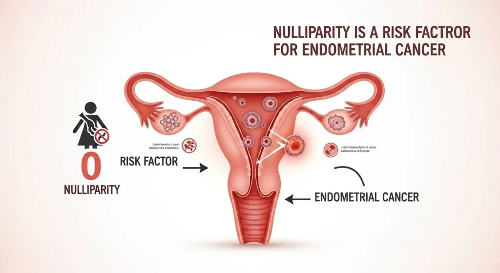 Is Nulliparity a Risk Factor for Endometrial Cancer ? | dr. lucas minig