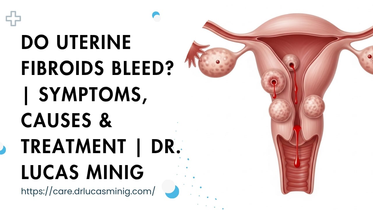 Do Uterine Fibroids Bleed? | Dr. lucas