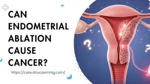 Can Endometrial Ablation Cause Cancer?