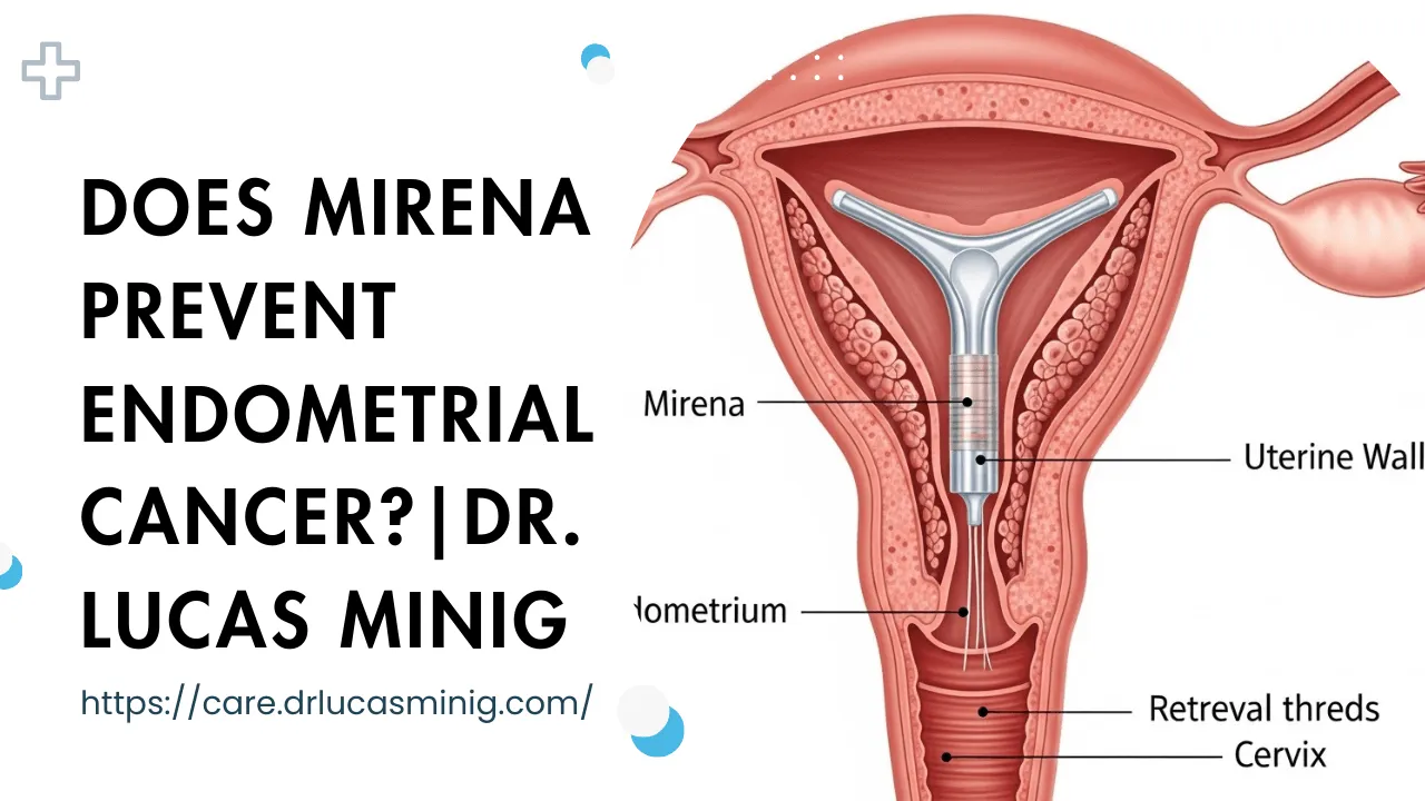 Does Mirena Prevent Endometrial Cancer?- Dr. Lucas