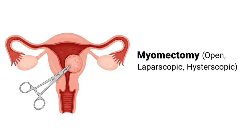 How to Treat Uterine Fibroids? | dr. lucas minig